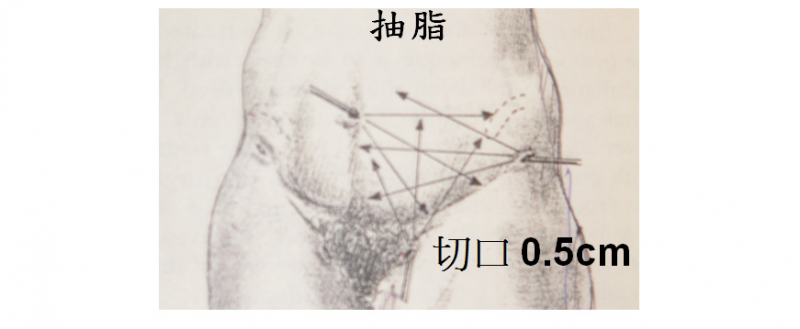 1479792787554039.jpg 11.jpg